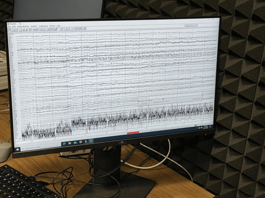 EEG Brain State & Seizure Detection